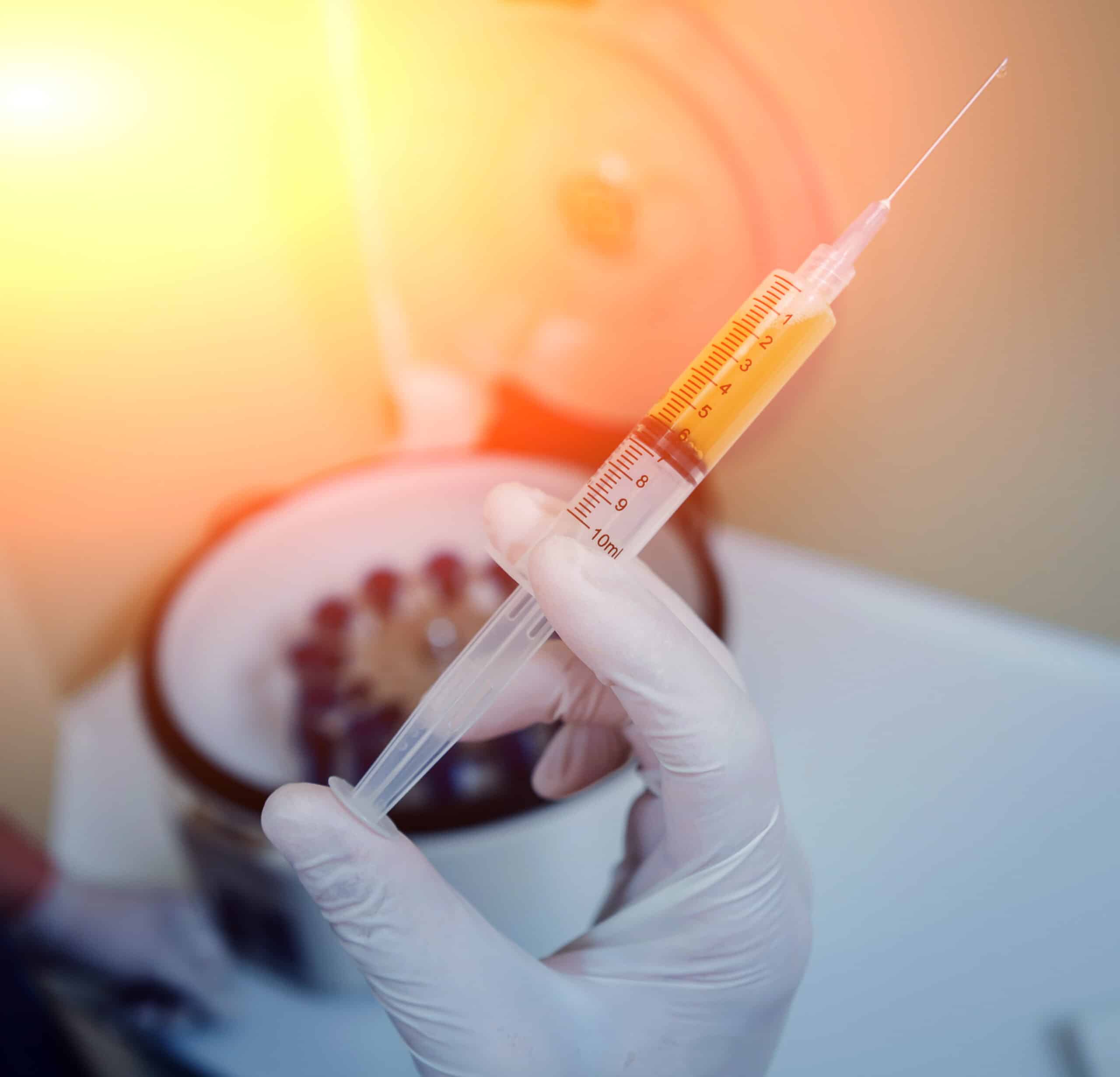 A syringe full of PRP in front of a centrifuge