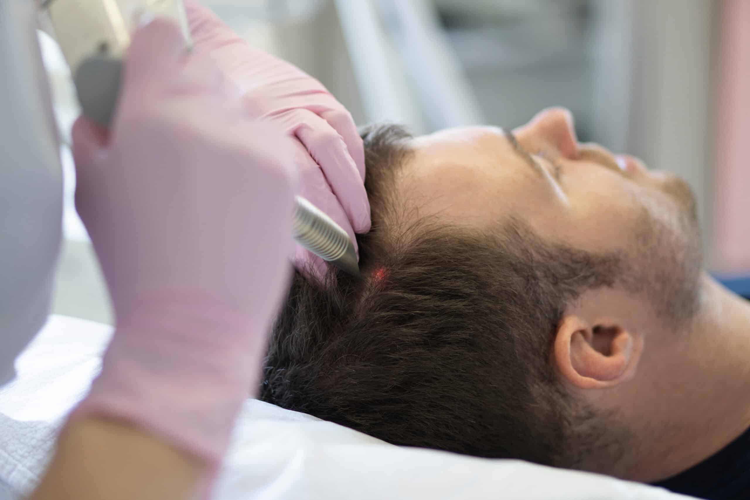 gloved hands shining a red laser medical device on a man's parted hair