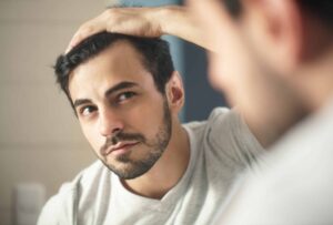 man looking into mirror pulling back his hair to examine his receding hairline